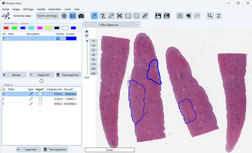 於Excilone®View標註數位玻片