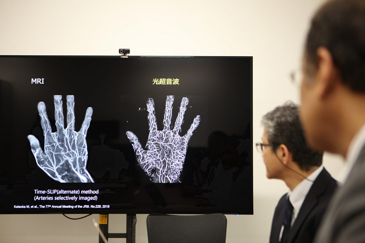 血管、MRI、光聲，MRI 及光聲技術於微血管成像之比較，光聲技術為label free利用血球自身成像更為精準高解析