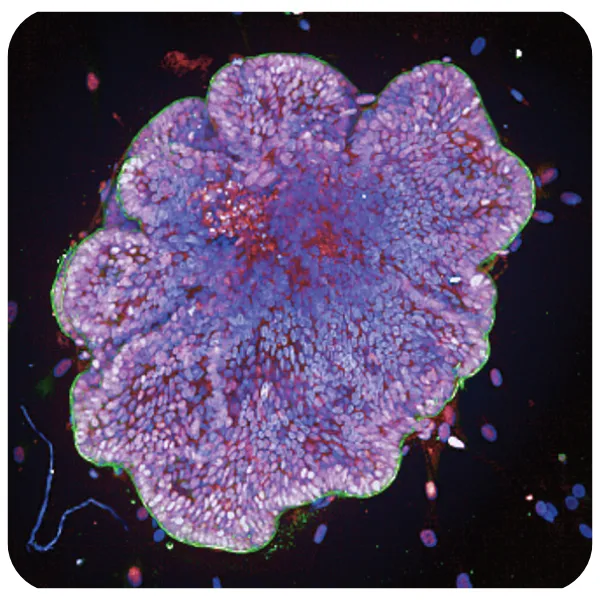 Opera Phenix OptIQ 拍攝之 3D 類器官共軛焦螢光影像範例|微透鏡轉盤共軛焦光學切片|類器官高內涵影像分析,對比 ImageXpress Micro Confocal、CV8000 HCS 平台