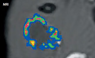 Customized MRI Agents - Tailored Solutions