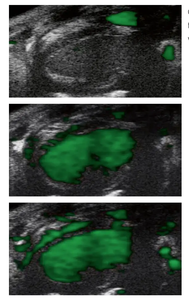 PolySon L Cardiac Perfusion Imaging in Mouse
