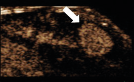 PolySon T Tumor Imaging in HCC Mouse Model