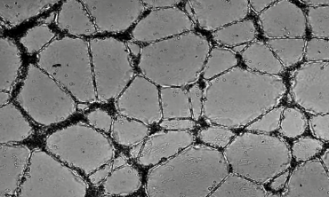 Cell tube assay Angiogenesis