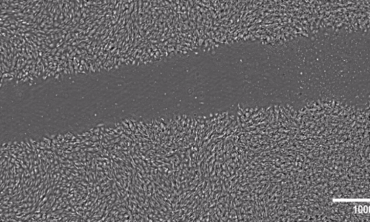 ound healing or cell migration