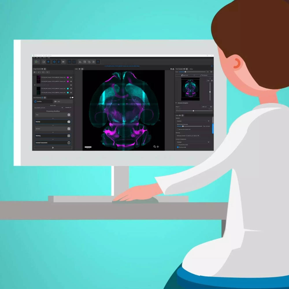 MACS iQ View 3D