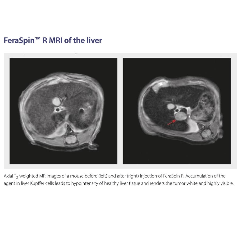 Viscover MRI 1000px_2