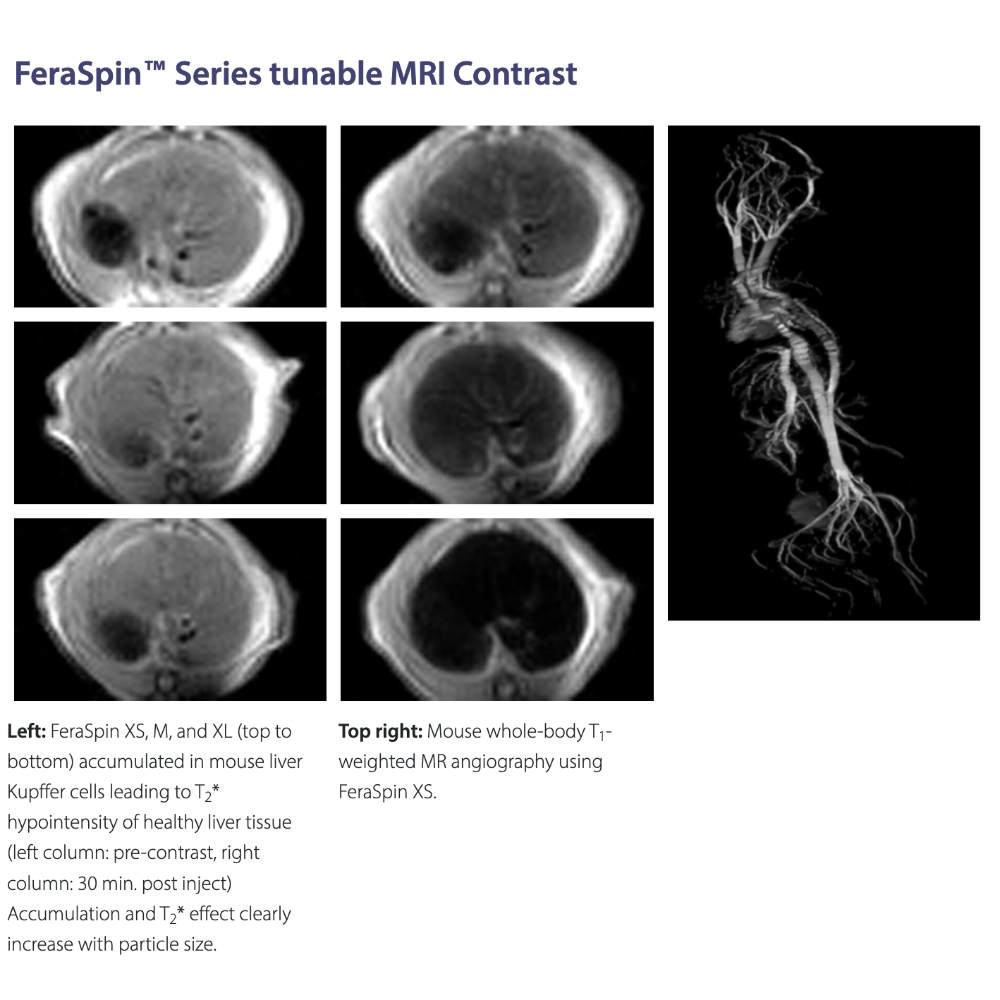 Viscover MRI 1000px_8