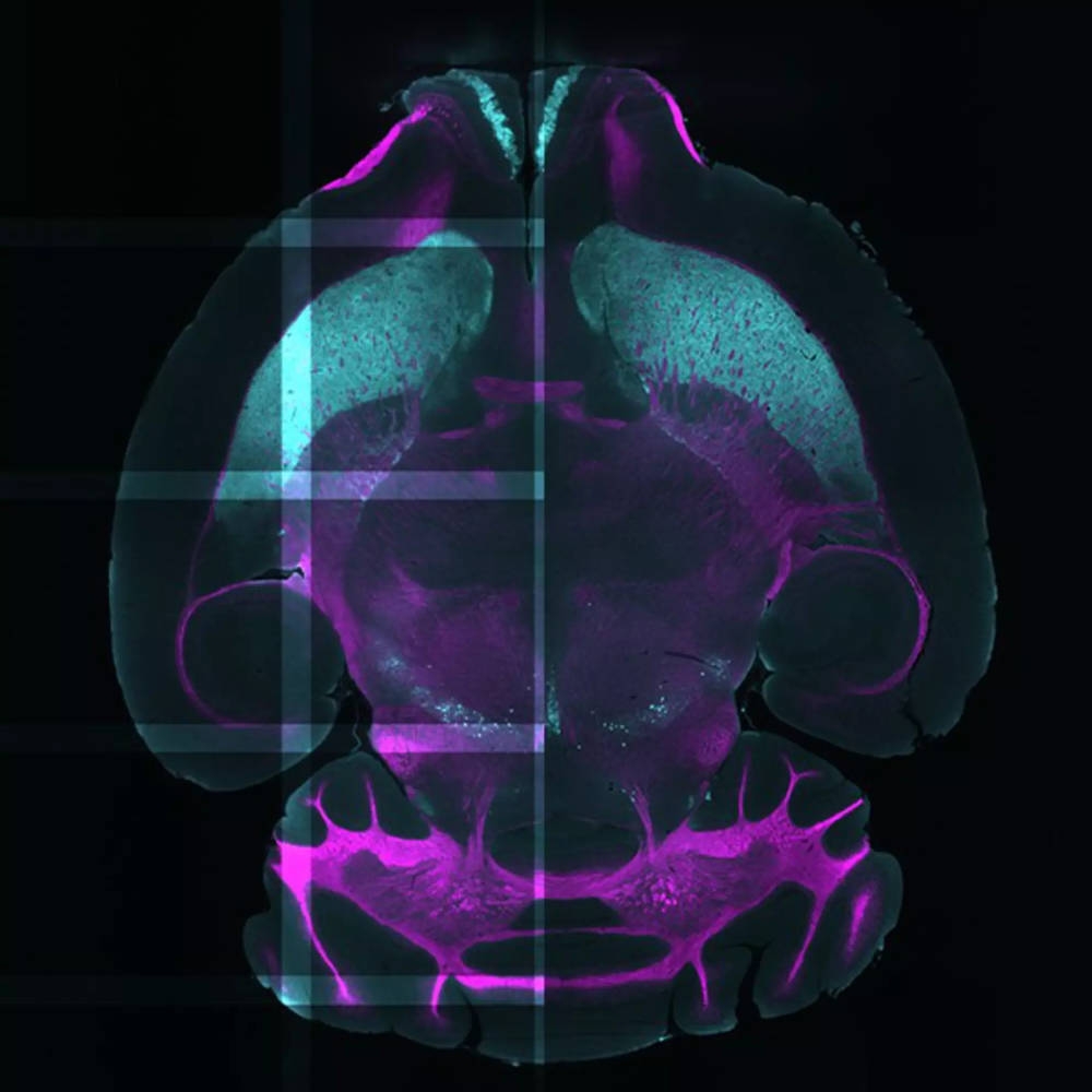 MACS iQ 3D LargeVolume_5