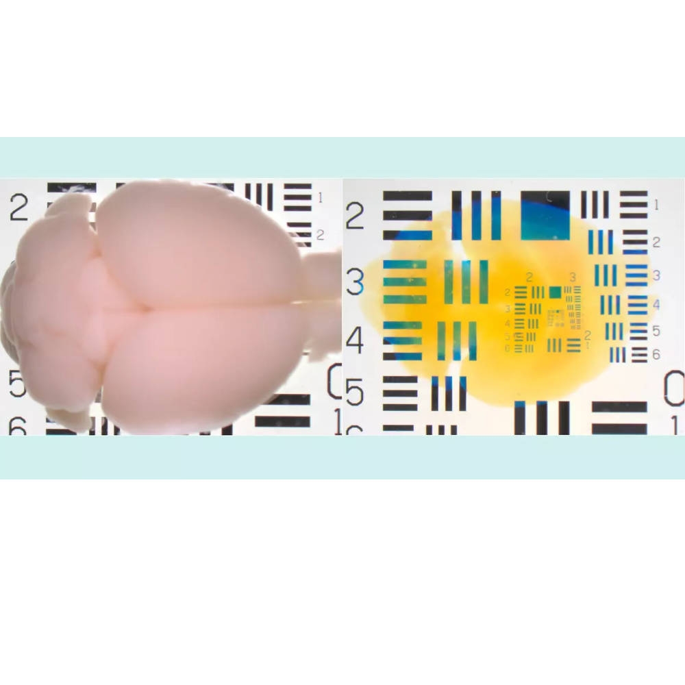 Tissue clearing – turning entire biological samples transparent.