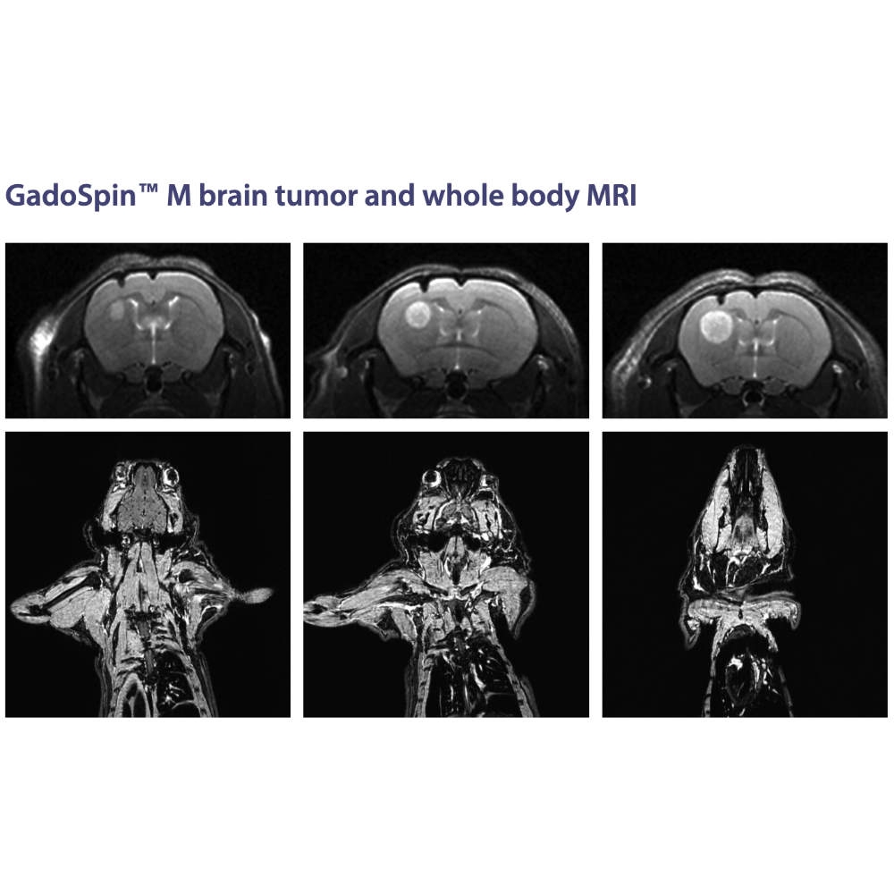 Viscover MRI 1000px_3