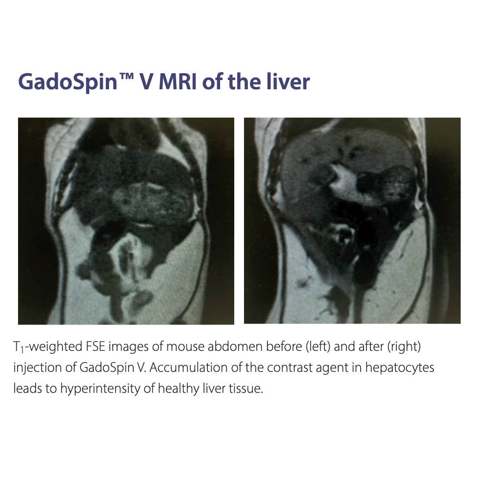 Viscover MRI 1000px_7